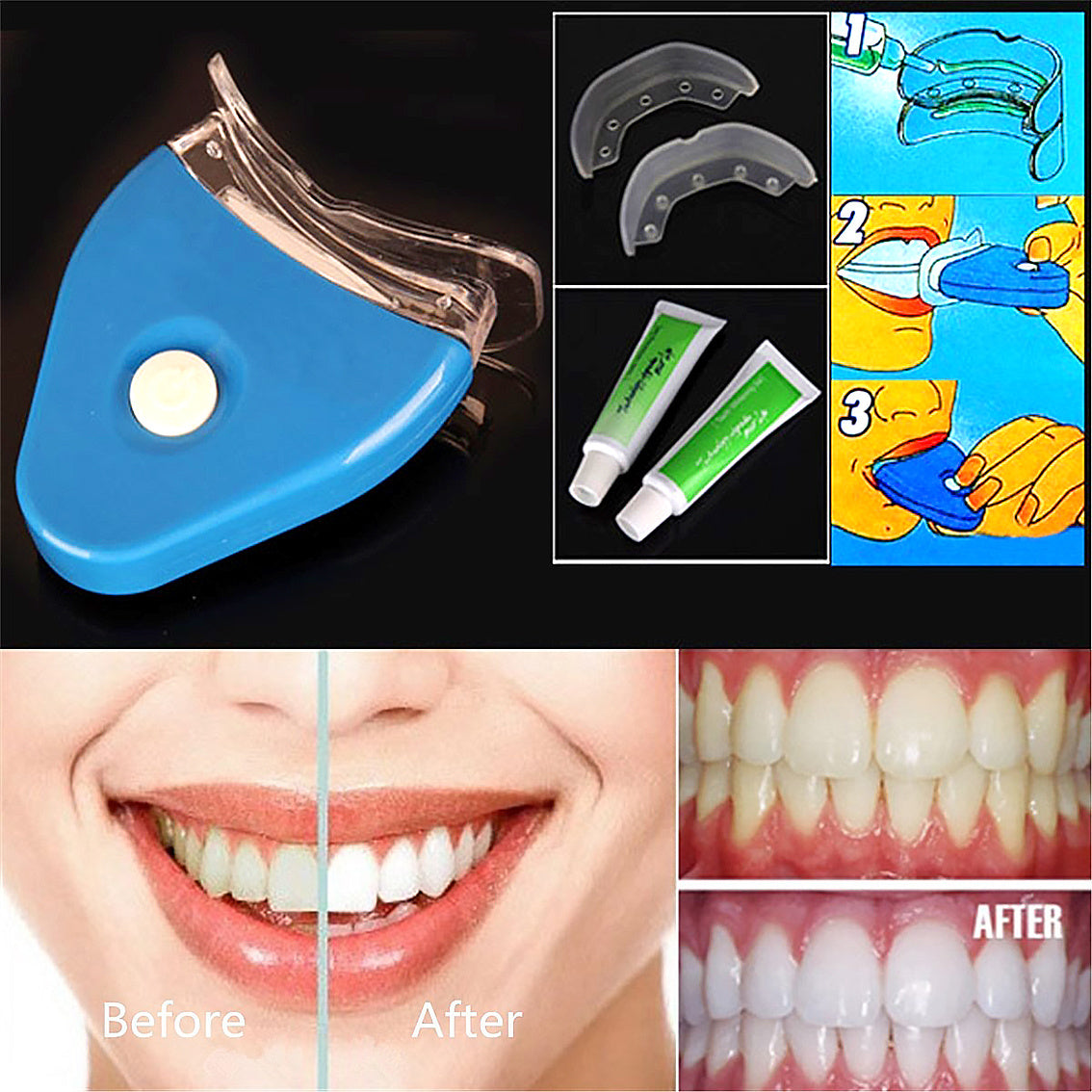 Whitener Dental Bleaching LED